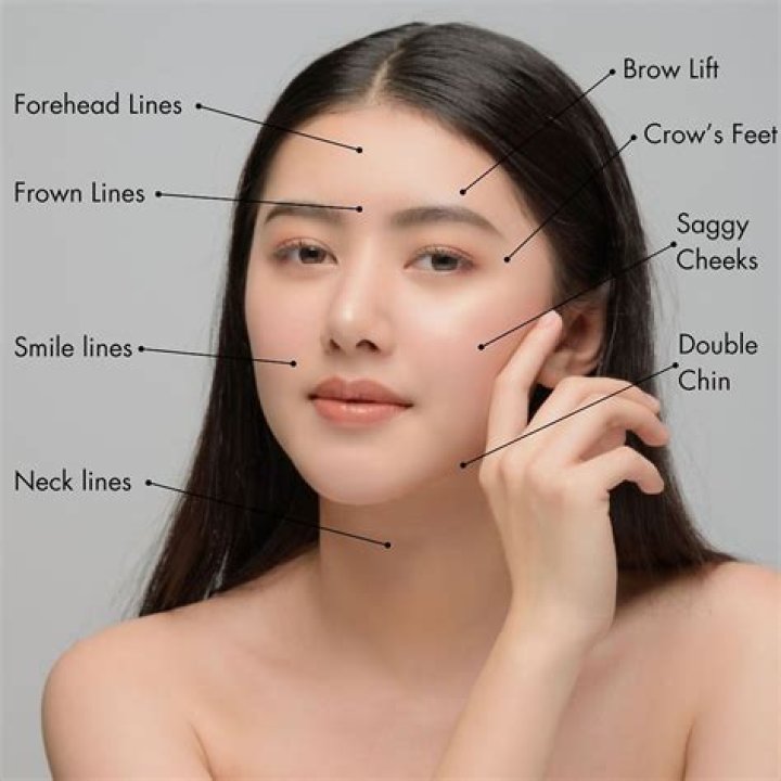 Embracing Time: Understanding All Of These Lines On My Face