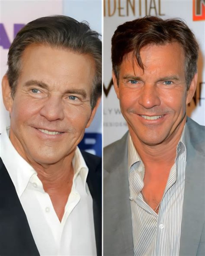 Exploring The Quaid Brothers: A Unique Legacy In Hollywood