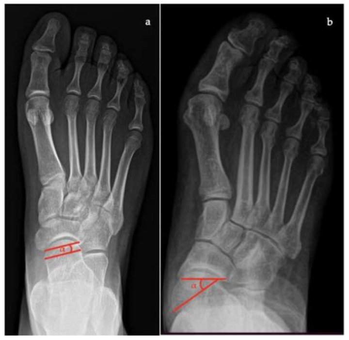 Micah Morris's Height: Uncovering The Stature Of A Prominent Figure