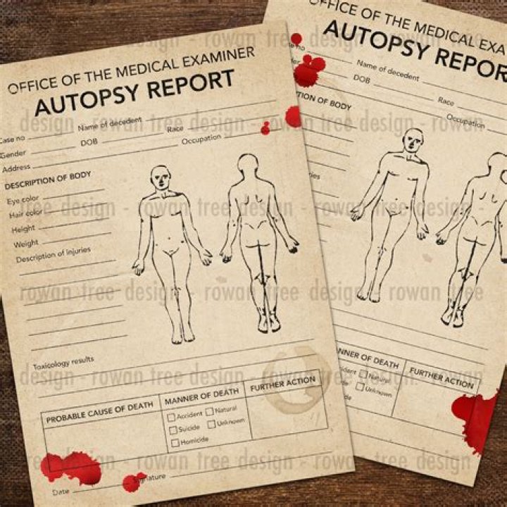 Unraveling The Mystery: The Ray Stevenson Autopsy Report